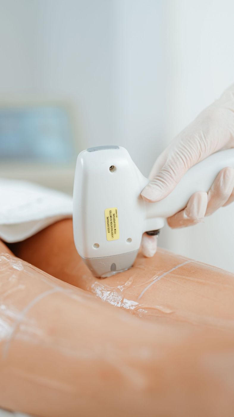 Epilare cu laser